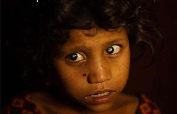 New Documentary Short Shows Why Early Intervention On Childhood Blindness Is Key To Preventing Extreme Poverty 6 New Documentary Short Shows Why Early Intervention On Childhood Blindness Is Key To Preventing Extreme Poverty 4