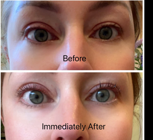 Lash Lift Kit: Get Longer-Lasting Curled Eyelashes 2 Lash Lift Kit: Get Longer-Lasting Curled Eyelashes 2