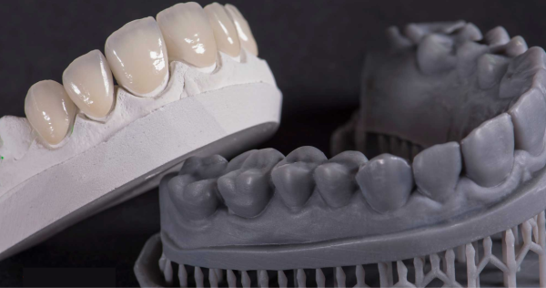 Dr. Joyce Kahng is Using 3D Printing Technology to Revolutionize her Dental Practice 3 Dr. Joyce Kahng is Using 3D Printing Technology to Revolutionize her Dental Practice 3