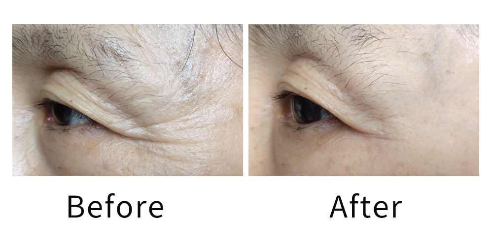 The Ultimate Guide to Instant Firming Anti-Wrinkle Eye Cream The Ultimate Guide to Instant Firming Anti-Wrinkle Eye Cream